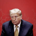 ¿Donald Trump enfermo? De esto se trata la insuficiencia venosa crónica